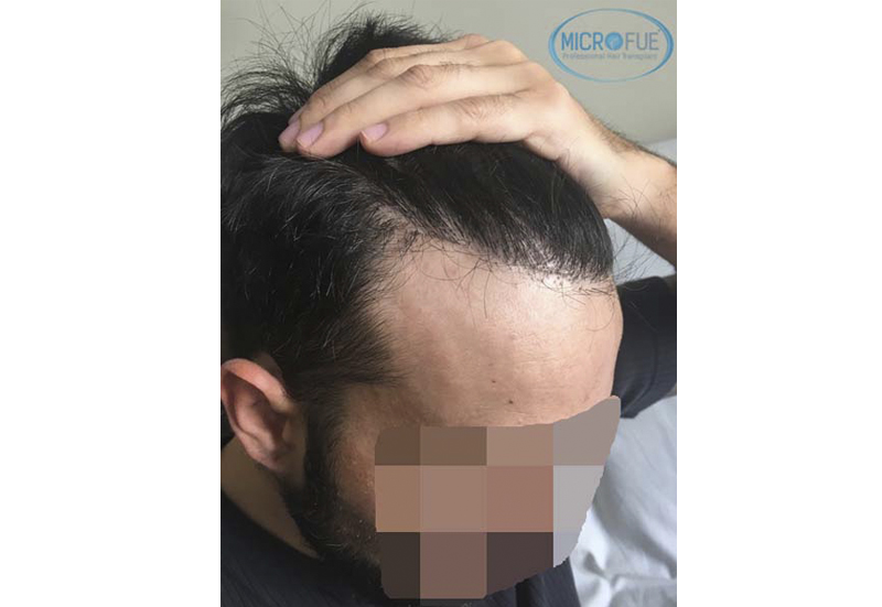 Recuperar pelo Recuperar pelo