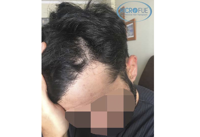 Recuperar pelo Recuperar pelo
