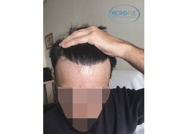 Recuperar pelo Recuperar pelo