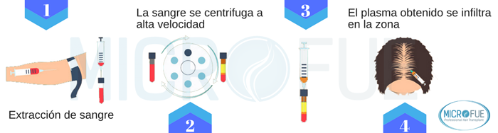 en_que_consiste_el_tratamiento_plasma_rico_en_plaquetas