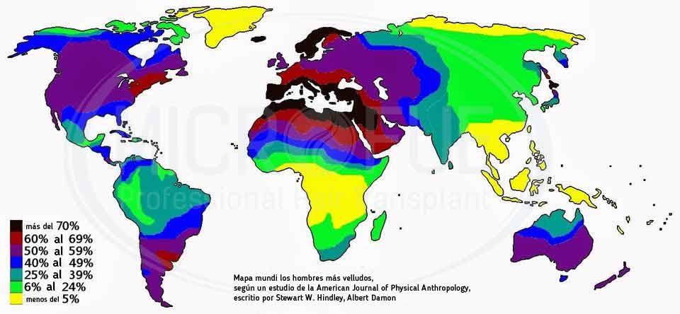 hombres_mas_peludos_del_mundo_mapa_trasplante_capilar_Turquia_microfue