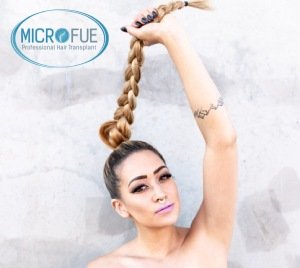 trenzas_peinados_tirantes_calvicie_femenina__microfue trenzas_peinados_tirantes_calvicie_femenina__microfue