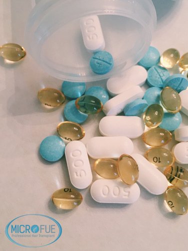 vitaminas_para_el_pelo_calvicie_Microfue vitaminas_para_el_pelo_calvicie_Microfue