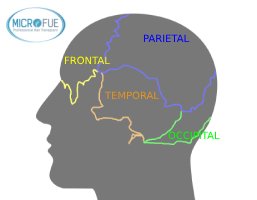 anatomía de la cabeza trasplante capilar zona frontal 