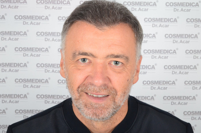 trasplante de pelo milinko pantic - pacientes de microfue trasplante de pelo milinko pantic - pacientes de microfue