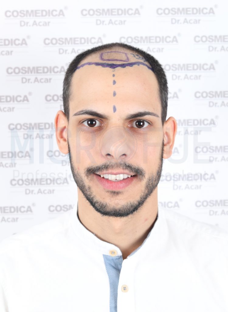 Alfonso Cuellar Romero-frontal-antes frontal antes