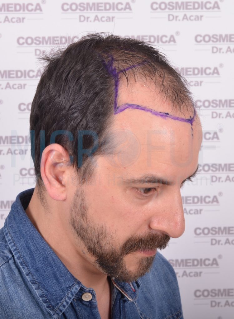 Jordi Galvez Garcia de Lara-lateral #10-antes #39 lateral antes