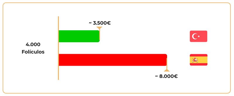 Injerto capilar en España o Turquía con precios aprox.