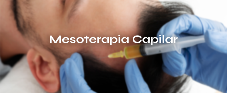 Imagen de mesoterapia capilar